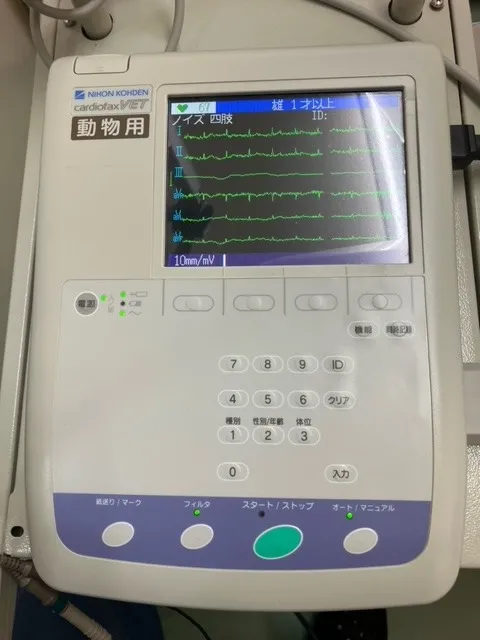 心電計